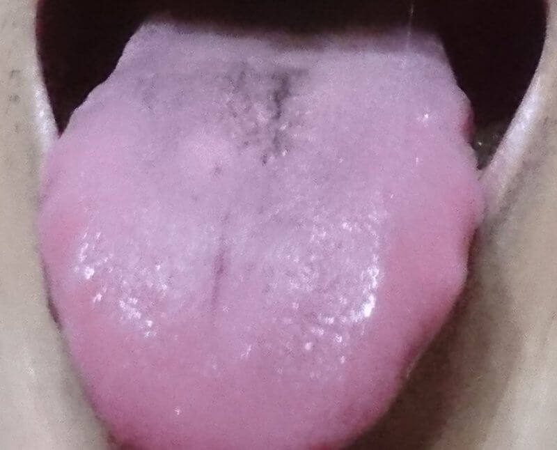 黒い舌